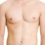 Male Chest Liposuction